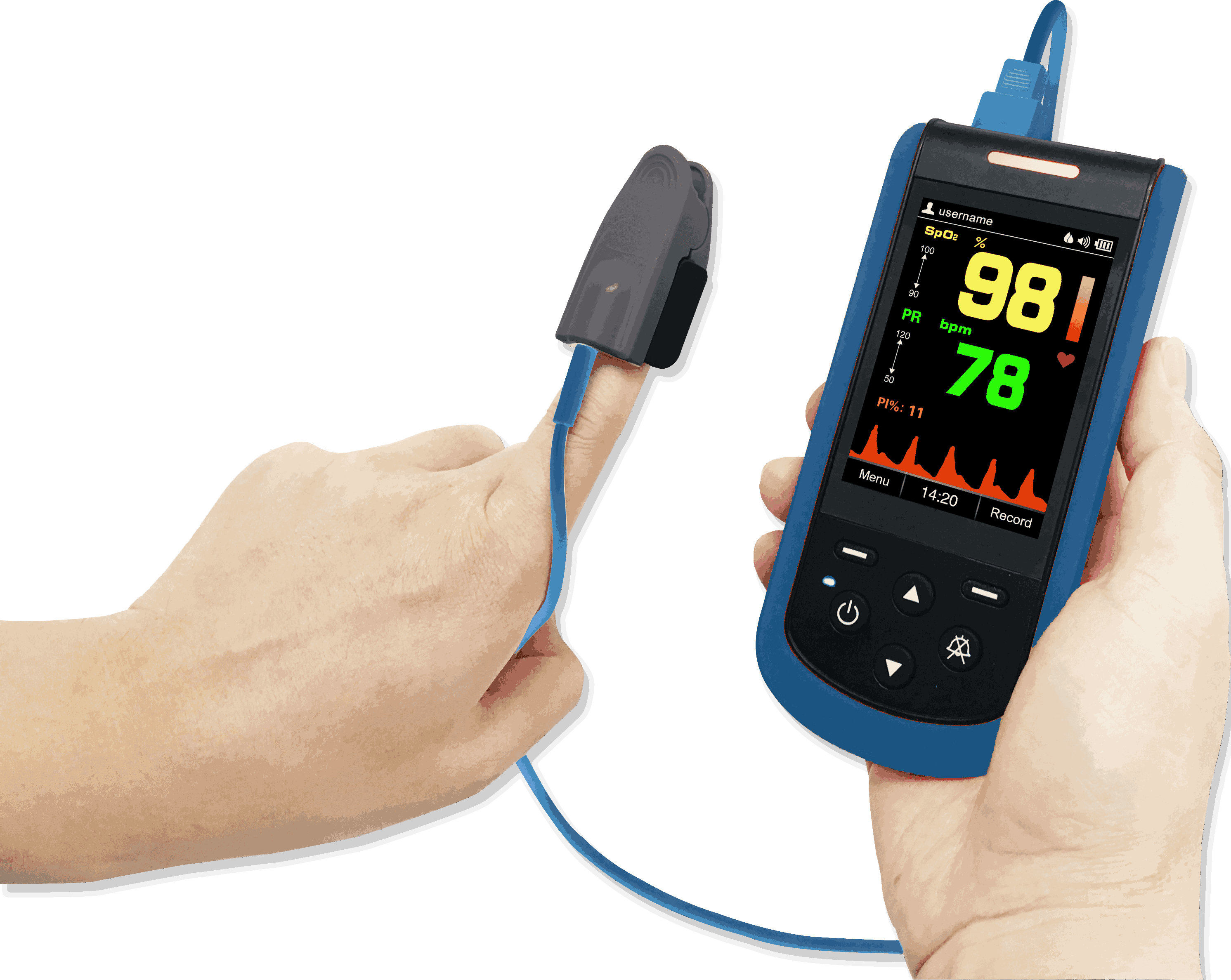 Handheld Pulse Oximeter MDcubes